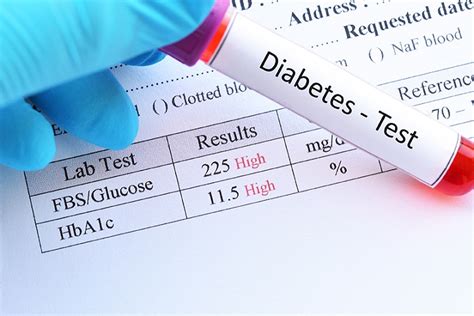 Glucose Lab Test