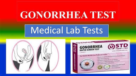 Gonorrhea Testing Methods