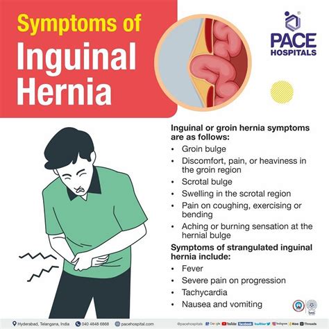 Groin Hernia Causes