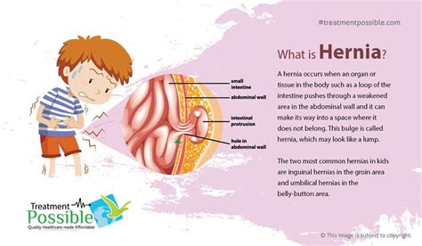 Groin Hernia In Children