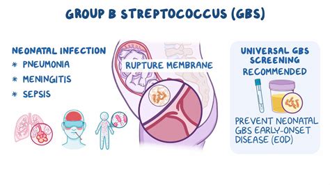 Group B Streptococcus