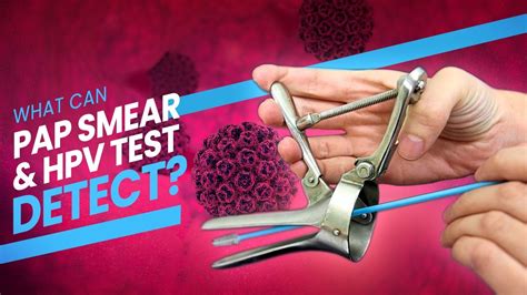HPV Test Next Steps