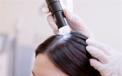 Hair Thinning Treatment Options
