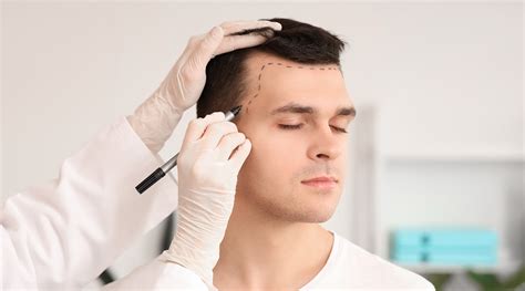 Hair Transplantation Technology