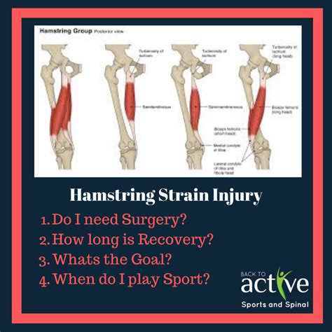 Hamstring Strain