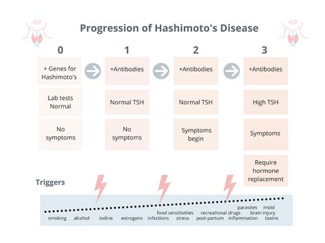 Hashimoto's Management