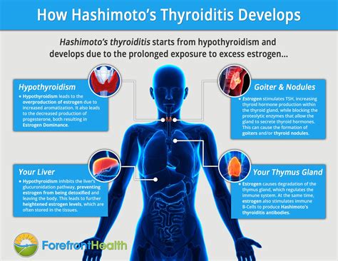 Hashimoto's Next Steps