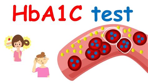 HbA1c Test Limitations and Considerations