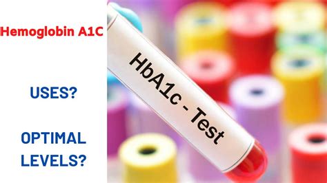 Hemoglobin A1c Test Conclusion