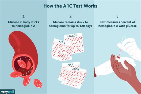 Hemoglobin A1c Test Results and Diabetes Management
