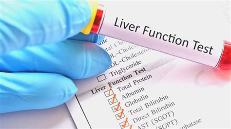 Hepatic Function Test Types
