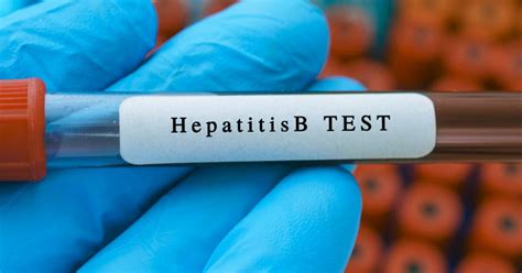 Hepatitis B Screening