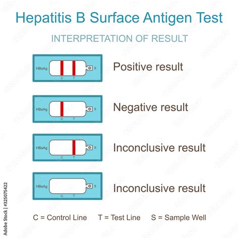 Hepatitis B Test Result Interpretation