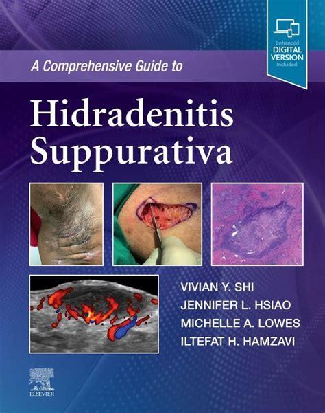 Hidradenitis Suppurativa Research