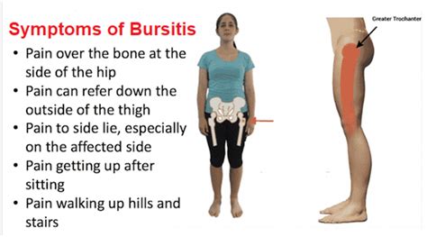 Hip Bursitis Symptoms