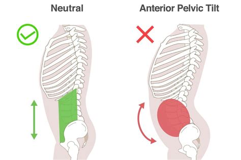 Hip Tilt Exercise Benefits