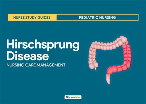 Hirschsprung's Disease Management