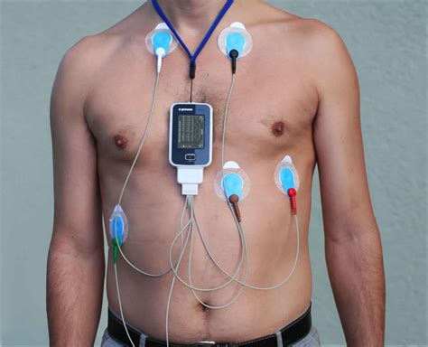 Holter Monitor Test