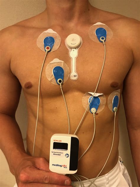 Advancements in Holter Technology
