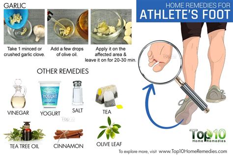 Home Remedies for Athlete's Foot