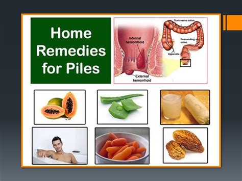 Home Remedies for Hemorrhoid Relief