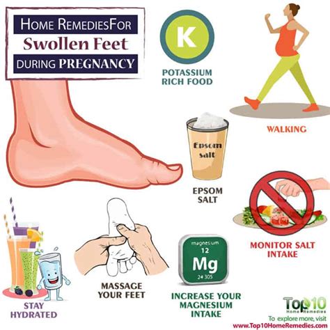 Home Remedies for Swollen Feet During Pregnancy