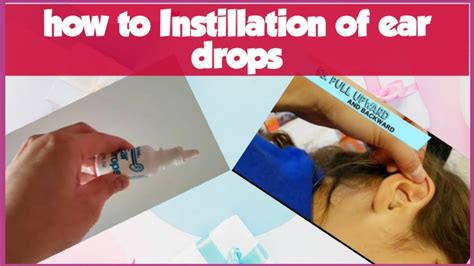 How Ear Drops Work