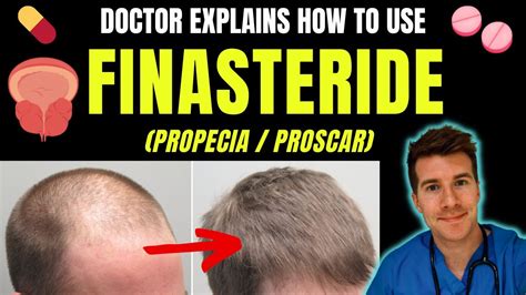 How Finasteride Works