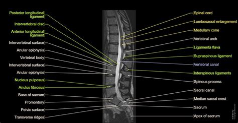 How MRI of Lumbar Spine Works