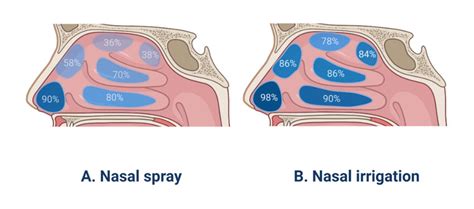 How Nasal Rinses Work