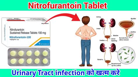 How Nitrofurantoin Works