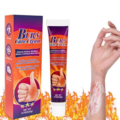 How To Use Ointment For Burns