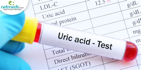 How is a Uric Acid Test Performed