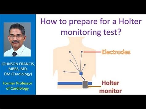 How to Prepare for Holter Monitor Test