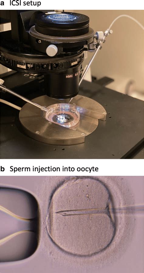 ICSI Procedure