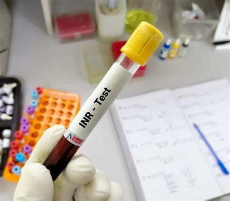 INR Blood Test Challenges