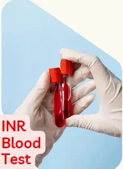 INR Blood Test Conclusion