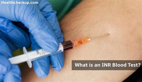 INR Blood Test Importance