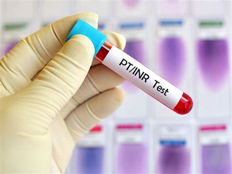 INR Blood Test Procedure