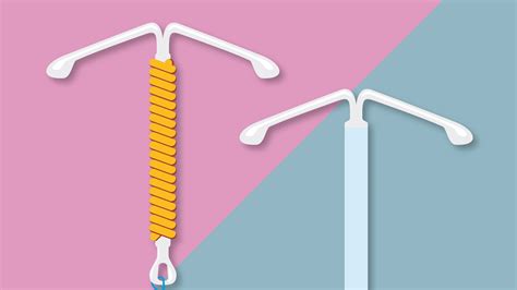 IUD Basics