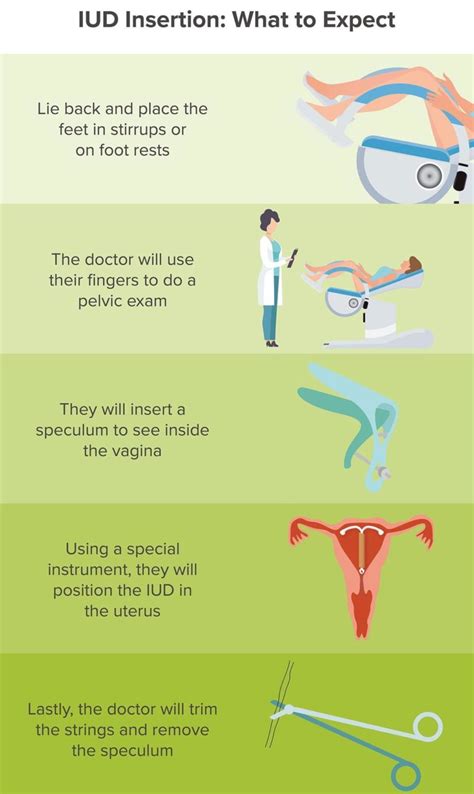 IUD Benefits