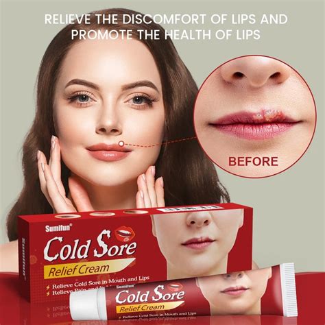 Ice on Cold Sore Relief