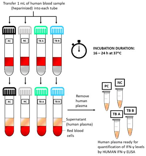 Igra Blood Test Procedure