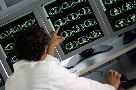 Imaging Studies