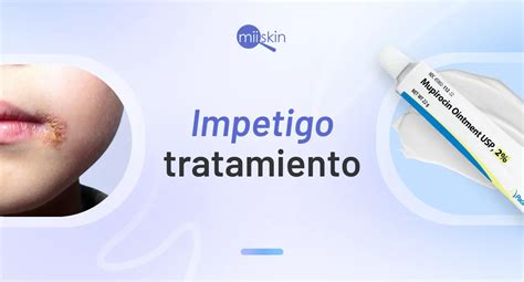 Impetigo Treatment