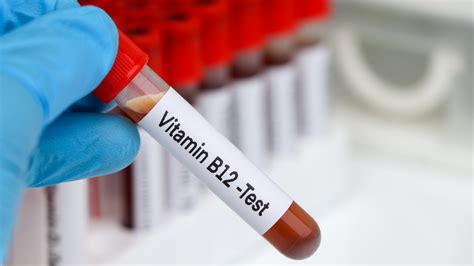 Importance of Vitamin B12 Testing