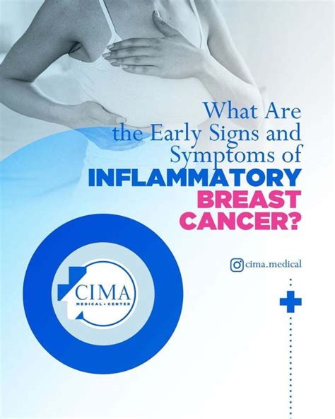 Inflammatory Breast Cancer Prevention