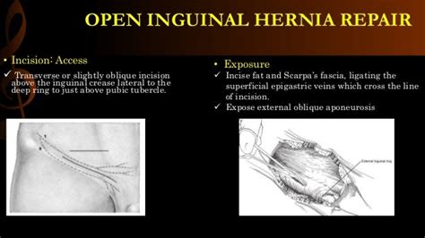 Inguinal Hernia Repair Surgery for Children