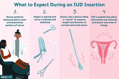 Insertion and Removal Process