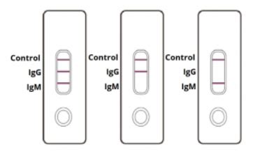 Interpreting COVID-19 Test Kit Results